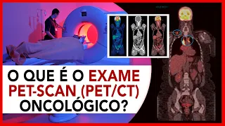 O que é o Exame Pet CT oncológico?