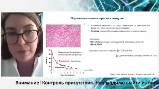 AL амилоидоз под маской цирроза печени. Клинический случай. Кудяшева О.В.