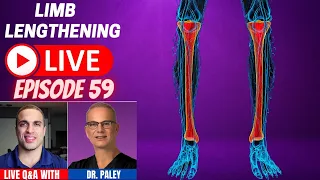 Limb Lengthening LIVE - Episode 59 - LIVE Q&A w/ Dr. Paley - [Exclusive Complications Edition]