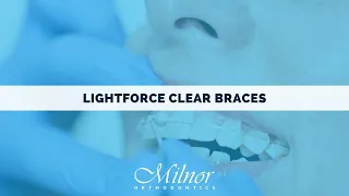 Lightforce Clear Braces