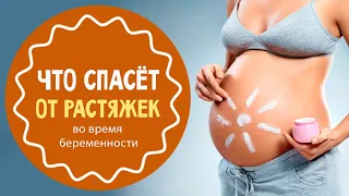 Растяжки на коже: что от них спасёт