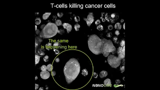 Label-free Live Cell Imaging: T-cells killing colon cancer cells