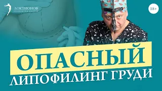 Стоит ли вводить жир в грудь? Каковы риски? Увеличение груди с помощью липофилинга / 18+