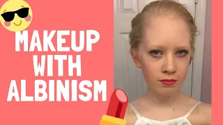 Makeup with Albinism