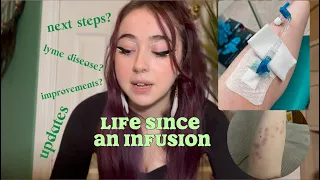 Life After An Infusion