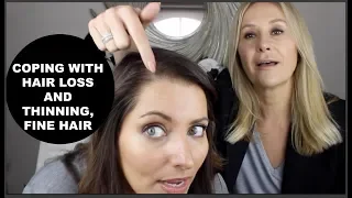 COPING WITH HAIR LOSS AND THINNING HAIR - NADINE BAGGOTT