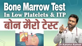 Bonemarrow Test in Low Platelets and ITP | Diagnosis of ITP | Dr Karuna Kumar | Hematologist