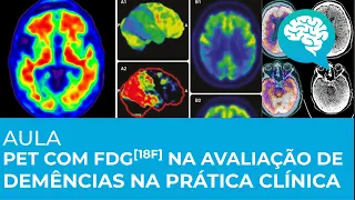 PET COM FDG[18F] NA AVALIAÇÃO DE DEMÊNCIAS NA PRÁTICA CLÍNICA aula DR SERGIO ALTINO