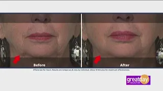 Plexaderm takes years off your face in just minutes