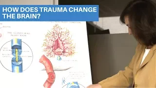 How Does Trauma Change The Brain? (Simple Guide)