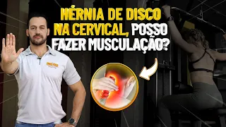 HÉRNIA DE DISCO NA CERVICAL, PODE FAZER MUSCULAÇÃO?  Fisioprev com Guilherme Stellbrink