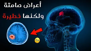 6 علامات تدل على نمو ورم في الدماغ !