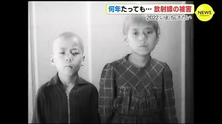 Hair fell out, arms were like threads...Atomic bomb radiation damage. 【Hibakusha's testimony】