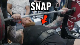 Hafthor RUPTURES PEC - Doctor Reacts to Thor Bjornsson Injury