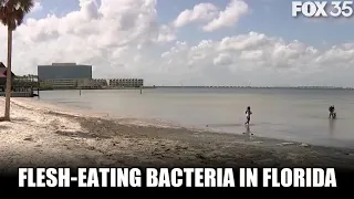 Two dozen cases of flesh-eating bacteria cases reported in Florida