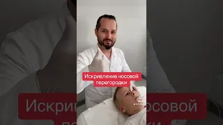 Поправить носовую перегородку без операции.￼