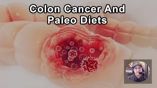 Patients Under 30 With Stage 3 And Stage 4 Colon Cancer Predominantly Due To Paleo Diets