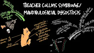 Treacher collins syndrome