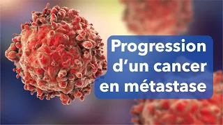 Cancer en progression : mécanisme d'une métastase