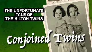 The Unfortunate Tale of the Hilton Twins