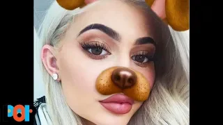 Teens Getting Plastic Surgery To Look Like Snapchat Filters