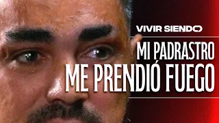 "Mi PADRASTRO me prendió FUEGO"