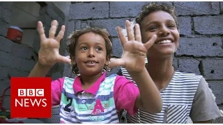 Yemen: Emad was 4 years old when a missile landed on his house.- BBC News