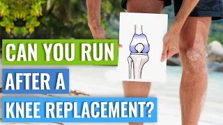 Can You Run After A Knee Replacement? Will Running Damage Your Replaced Knee?