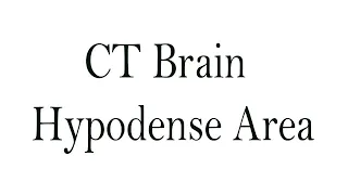 CT hypodense area