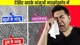 HOW HUMAN TEARS LOOKS UNDER MICROSCOPE | देखिए आपके आंसुओं माइक्रोस्कोप में |RSI