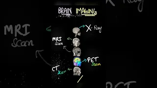 Types of brain imaging - MRI , CT scan kaisa dikhta hai