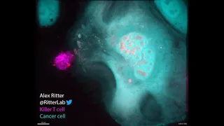 Killer T cells destroying cancer cells- Actual footage! #shorts