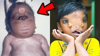 10 Most Unusual And Rare Humans That Are One in a Million