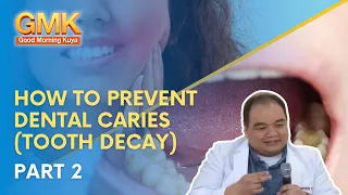 How to Prevent Dental Caries (Tooth Decay) Part 2/3 | Usapang Pangkalusugan