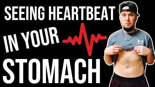 Seeing & Feeling Your Heartbeat or Pulse In Your Stomach! - Health Anxiety Nightmare