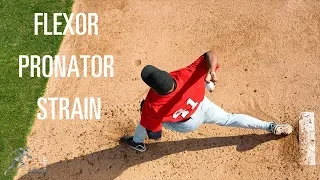 When can you return to pitching after a flexor pronator strain?