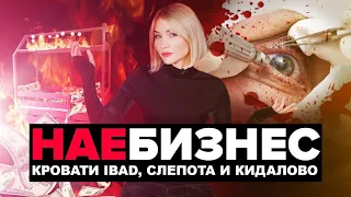 НА*БИЗНЕС | Развод на 2 миллиона, Врачебная ошибка и Паленые рюкзаки