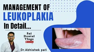 MANAGEMENT OF LEUKOPLAKIA IN DETAIL