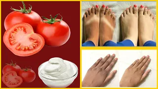 How To Remove Tan From Face, Neck, Hands, Knees Overnight| Simple home remedies | SIRI TV |