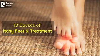 10 CAUSES OF ITCHY FEET: How to get relief ? Right Treatment - Dr. Urmila Nischal |Doctors' Circle