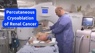 Percutaneous Cryoablation of Renal Cancer using the ProSense System (Short)