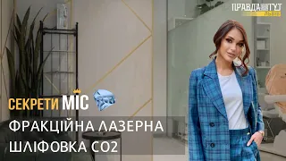 Фракційна лазерна шліфовка CO2: як позбутися зморщок та постакне? #СекретиМІС