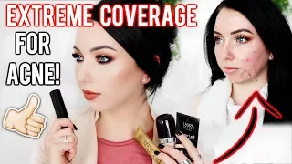 MY TOP FOUNDATIONS FOR ACNE & TEXTURED SKIN! Full/Extreme Coverage Makeup | Fair Skin