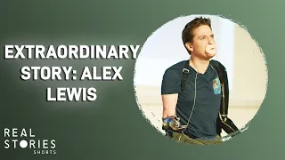 The Extraordinary Case of Alex Lewis #short