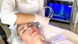 ПРОЦЕДУРА ВАКУУМНЫЙ ГИДРОПИЛИНГ HYDRAFACIAL