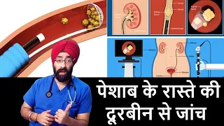 What is Ureteroscopy | दूरबीन से पेशाब के रास्ते की जांच | Dr.Education