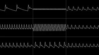 Shogoon - “Do Nothing for 3 Minutes” (C64) [Oscilloscope View]