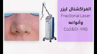 الفراكشنال ليزر وأنواعه - Fractional laser