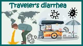 Traveler’s Diarrhea | Causes, Risk Factors, Symptoms, Diagnosis, Treatment | Animated biology