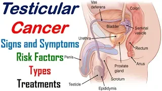 Testicular Cancer - Signs, Symptoms, Risk Factors, Types and Treatments - Cancer Knowledge